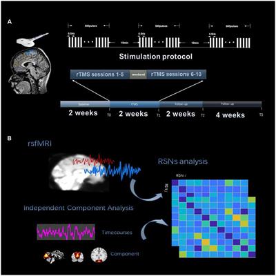 Antiepileptic Efficacy and Network Connectivity Modulation of Repetitive Transcranial Magnetic Stimulation by Vertex Suppression